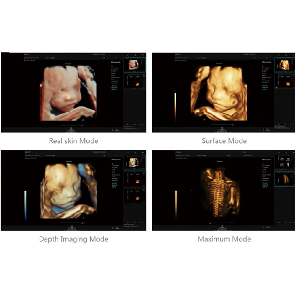 Sisteme-de-ultrasonografiere-HISENSE-HD60-series