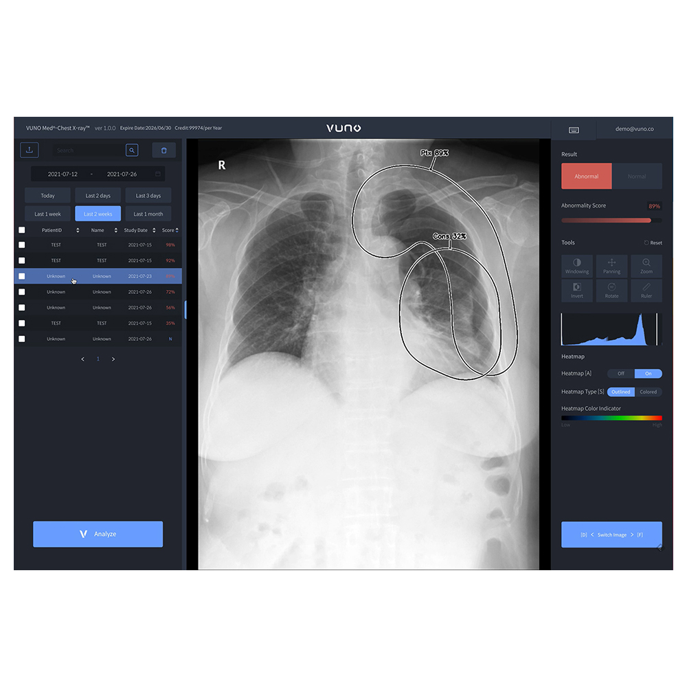 VUNO - Soft inteligentra artificiala