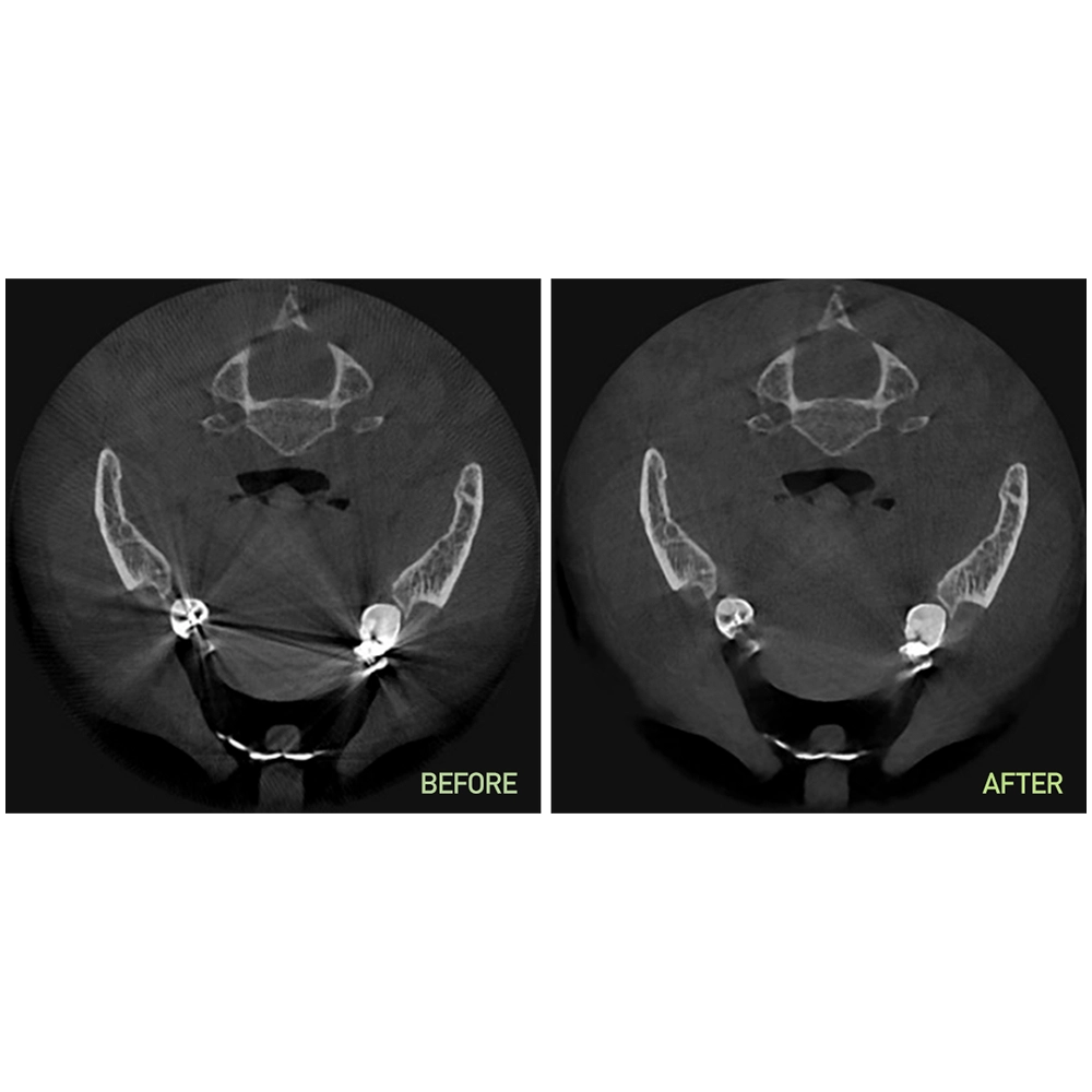sistem-imagistica-radiologica-dentara-4-in-1-papaya-3d-plus-genoray-4